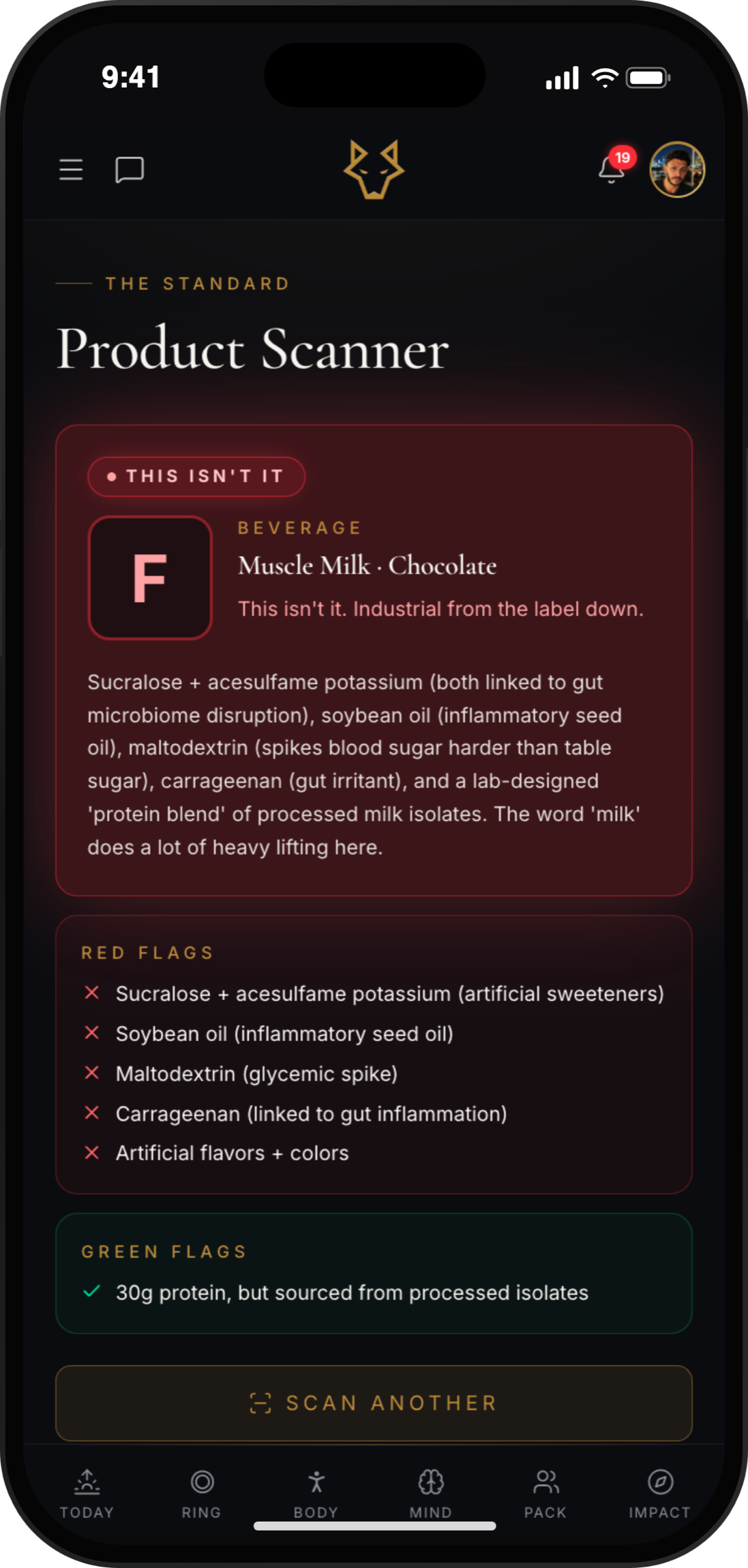 Scanner. Every red flag on the label
